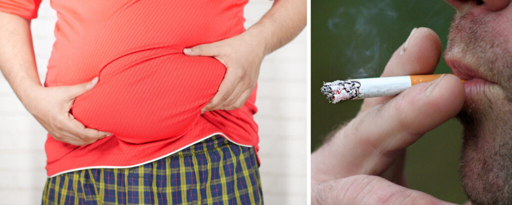 A man holding his belly on the left, and a man smoking a cigarette on the right. Both obesity and smoking are causes of DVT.