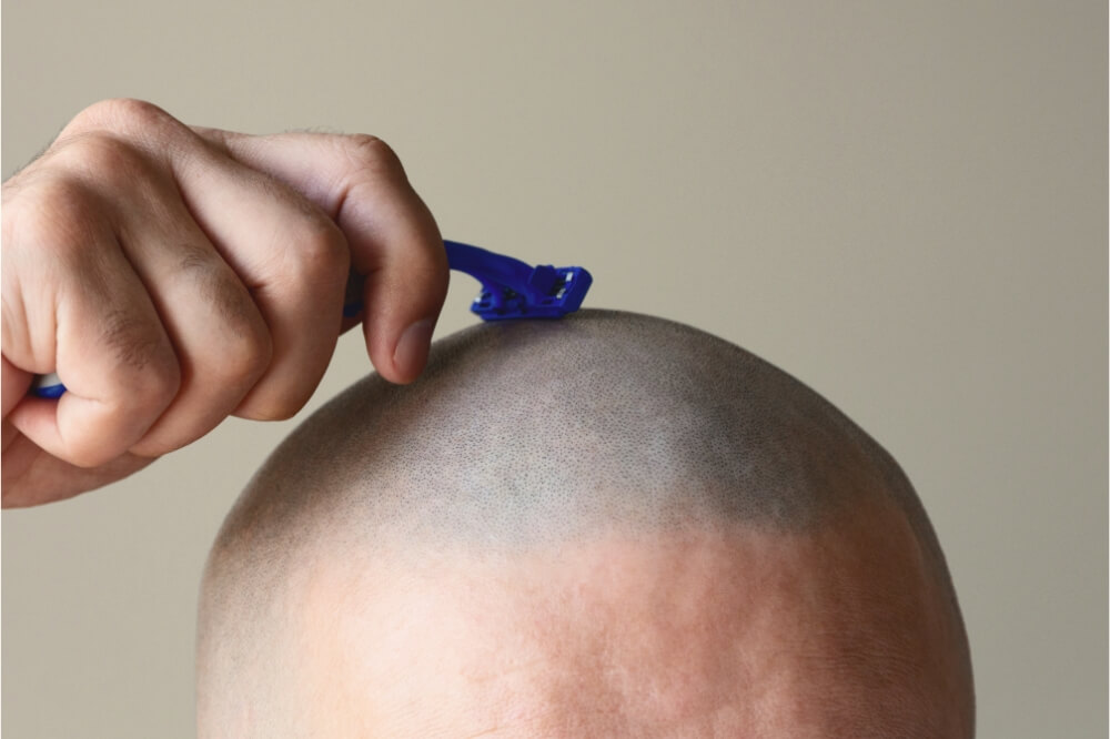 A man holding a razor to his stubbly head.