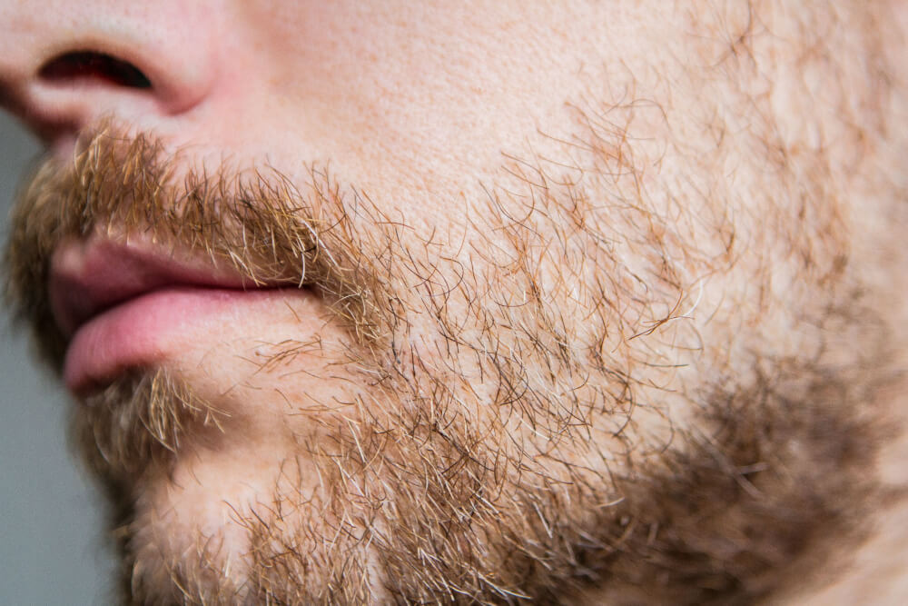 Close up of a patchy full beard.